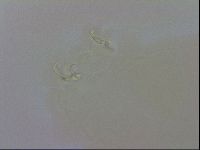 Doryphoribius evelinae image