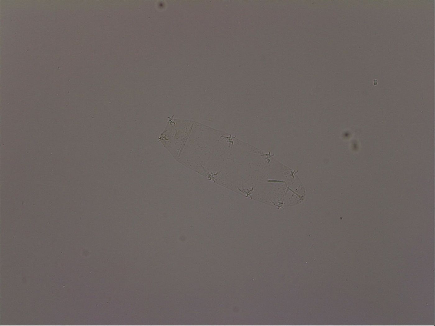 Mesocrista image