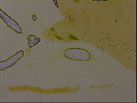Thulinius augusti image