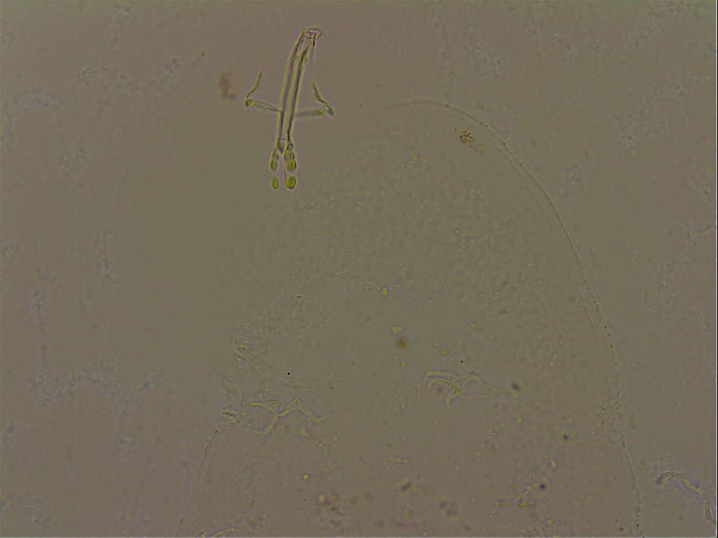 Isohypsibius canadensis image
