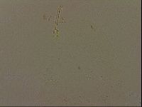 Isohypsibius canadensis image