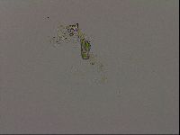 Isohypsibius granulifer image
