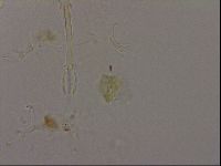 Isohypsibius granulifer image