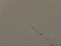 Isohypsibius granulifer image