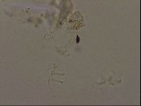 Isohypsibius granulifer image