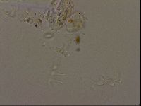 Isohypsibius granulifer image