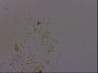 Isohypsibius granulifer image