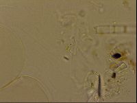 Isohypsibius granulifer image