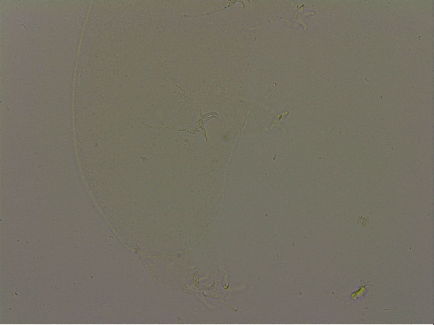 Isohypsibius granulifer granulifer image