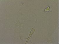 Isohypsibius granulifer image