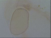 Isohypsibius granulifer image