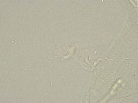 Isohypsibius granulifer image