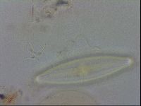 Isohypsibius granulifer image