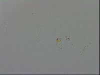 Isohypsibius granulifer image