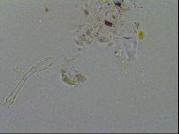 Isohypsibius granulifer image