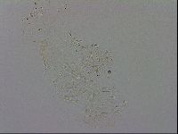 Isohypsibius granulifer image