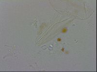 Isohypsibius granulifer image
