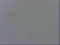 Isohypsibius granulifer image
