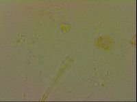 Isohypsibius granulifer image