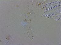 Isohypsibius granulifer image