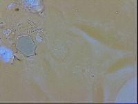 Isohypsibius granulifer image