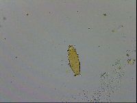 Isohypsibius macrodactylus image