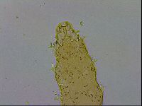Isohypsibius macrodactylus image