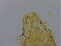 Isohypsibius macrodactylus image