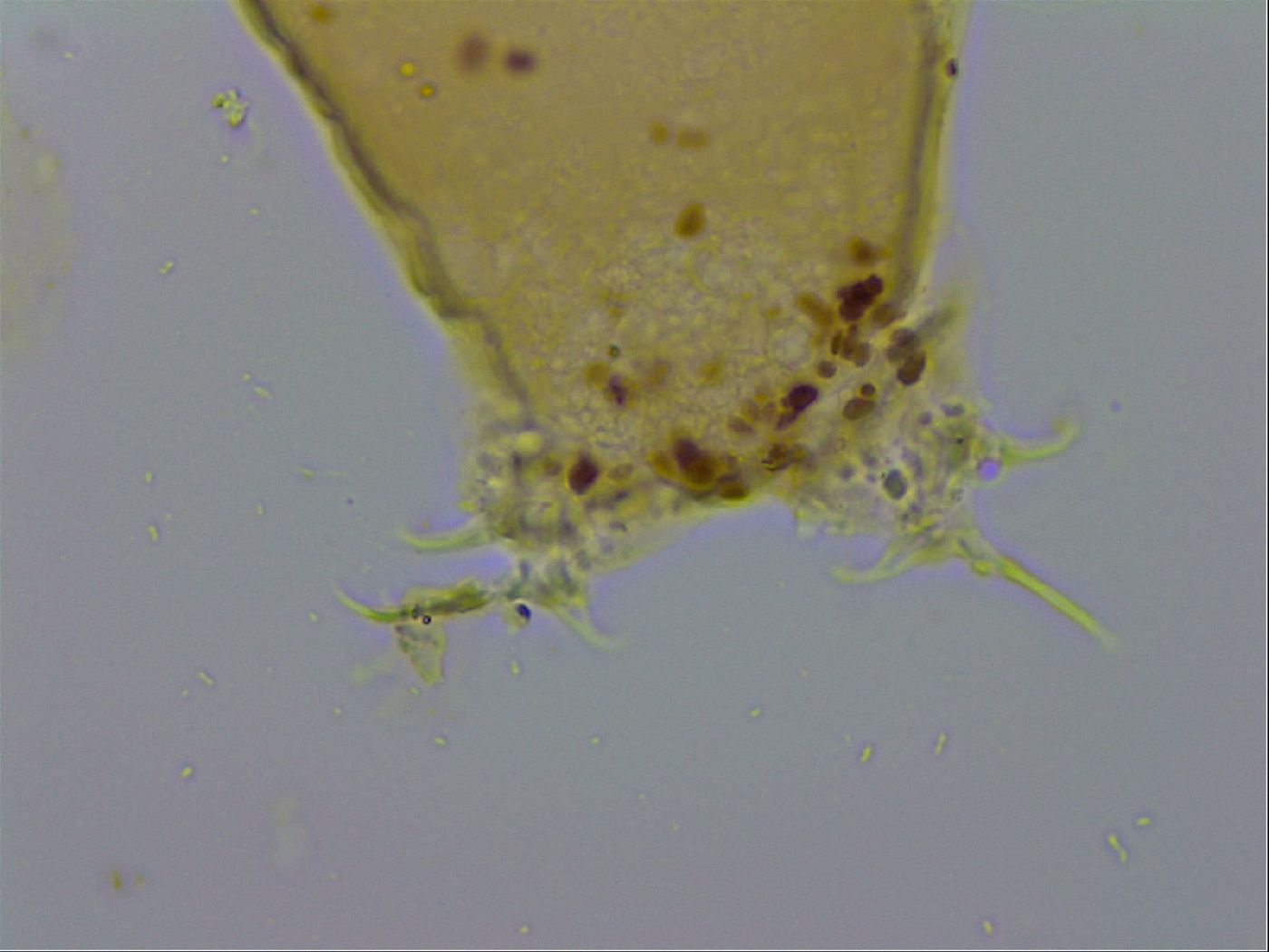 Isohypsibius macrodactylus image