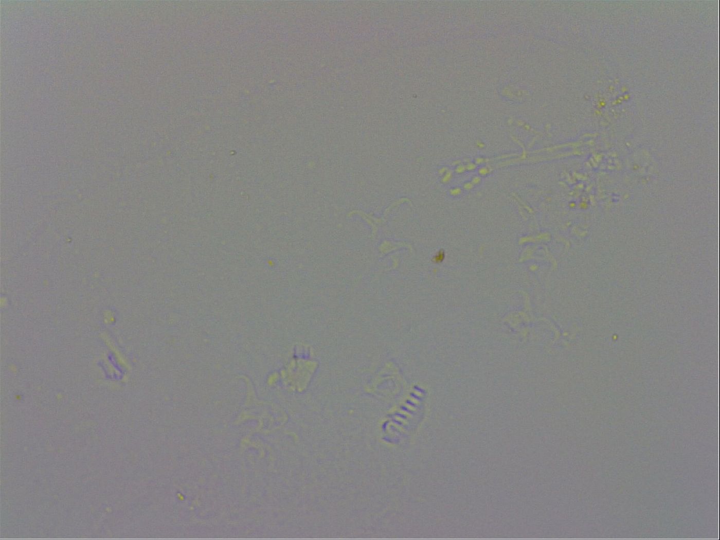 Isohypsibius papillifer image