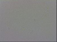 Isohypsibius papillifer image