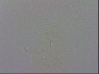 Isohypsibius prosostomus image
