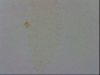 Isohypsibius prosostomus image