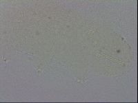 Isohypsibius prosostomus image