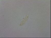 Isohypsibius prosostomus image