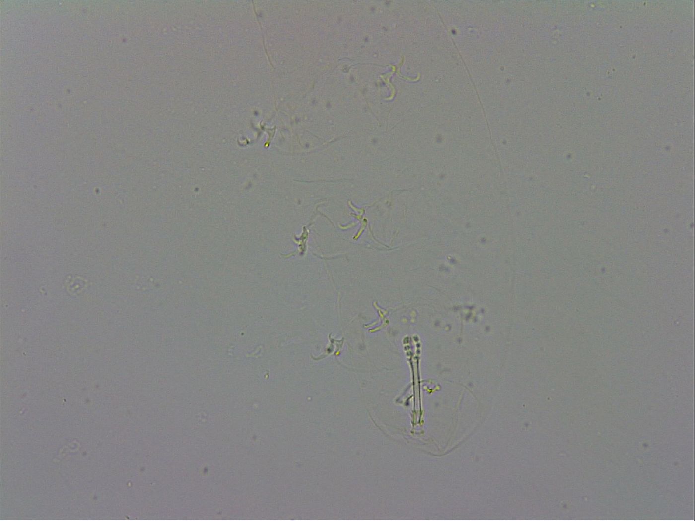 Isohypsibius prosostomus image