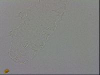 Isohypsibius prosostomus image
