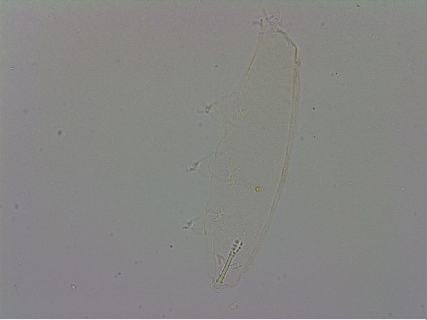 Isohypsibius prosostomus image
