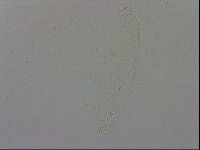 Isohypsibius prosostomus image