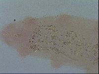 Isohypsibius prosostomus image