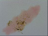 Isohypsibius prosostomus image