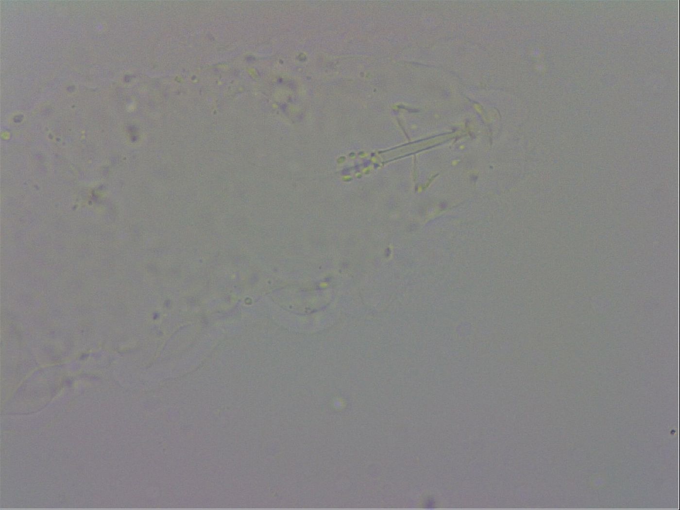 Isohypsibius prosostomus image