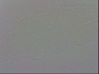 Isohypsibius prosostomus image