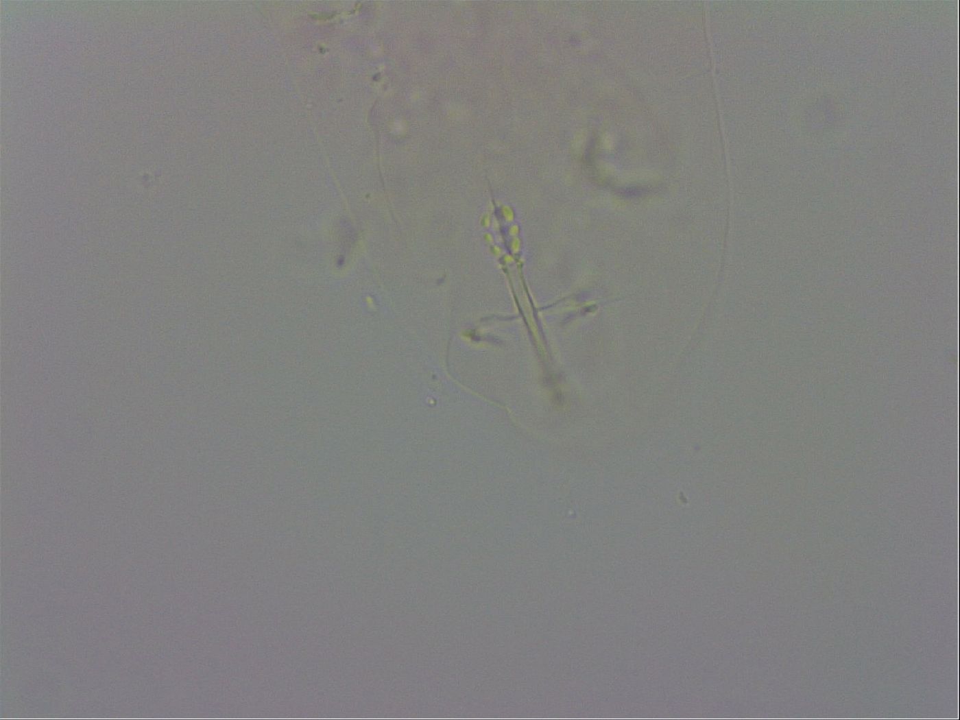 Isohypsibius prosostomus image