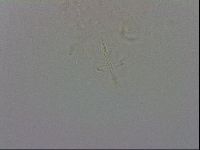 Isohypsibius prosostomus image