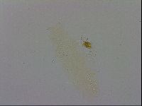 Isohypsibius prosostomus image
