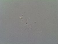 Isohypsibius prosostomus image