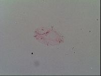 Isohypsibius prosostomus image