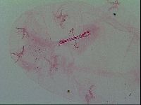 Isohypsibius prosostomus image