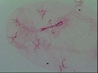Isohypsibius prosostomus image